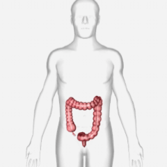 Σκωλικοειδίτιδα Appendicites